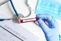 В Украине обнаружили 7235 новых случаев инфицирования коронавирусом