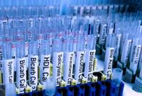WADA подозревает 300 спортсменов из РФ в допинговых нарушениях